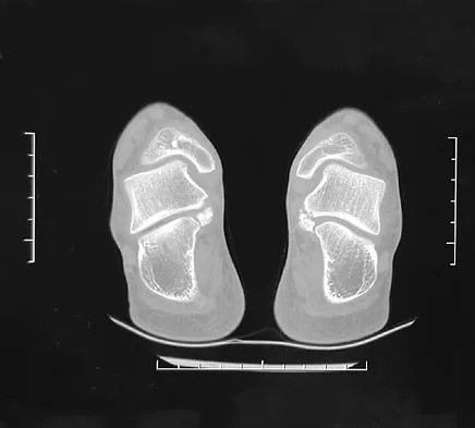 Foot & Ankle 2006 Practice Questions: Set 1 (Solved) - Figure 25
