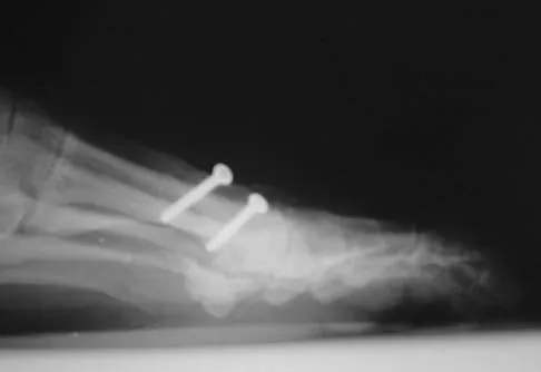 Foot & Ankle 2006 Practice Questions: Set 1 (Solved) - Figure 8