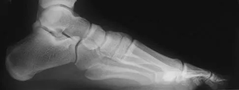 Foot & Ankle Board Review 2006: High-Yield MCQs (Set 2) - Figure 14