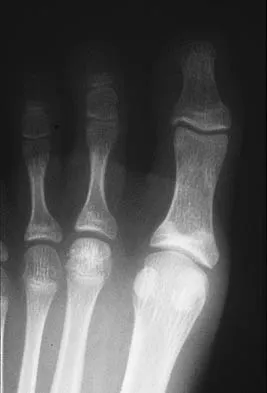 Foot & Ankle Board Review 2006: High-Yield MCQs (Set 2) - Figure 15