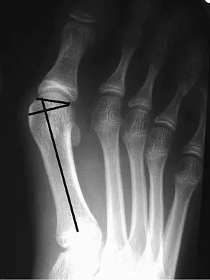 Foot & Ankle Board Review 2006: High-Yield MCQs (Set 2) - Figure 2