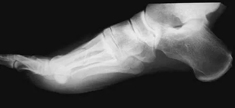 Foot & Ankle Board Review 2006: High-Yield MCQs (Set 2) - Figure 20