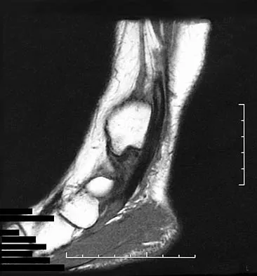 Foot & Ankle Board Review 2006: High-Yield MCQs (Set 2) - Figure 26