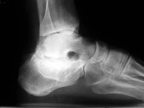 Foot & Ankle Board Review 2006: High-Yield MCQs (Set 2) - Figure 27