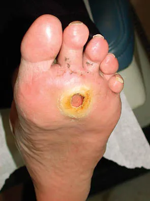 Foot & Ankle Board Review 2006: High-Yield MCQs (Set 2) - Figure 29