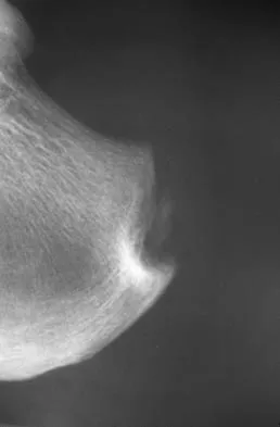 Foot & Ankle Board Review 2006: High-Yield MCQs (Set 2) - Figure 7