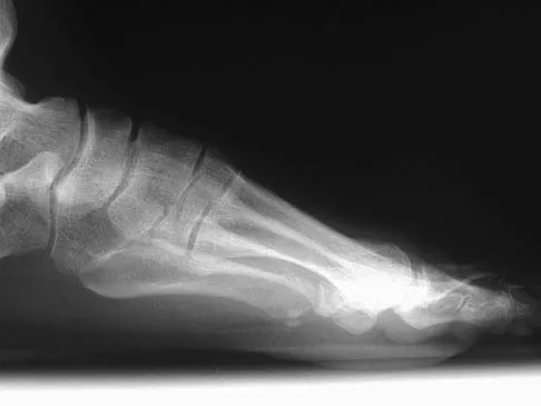 Foot & Ankle Board Review 2006: High-Yield MCQs (Set 2) - Figure 9