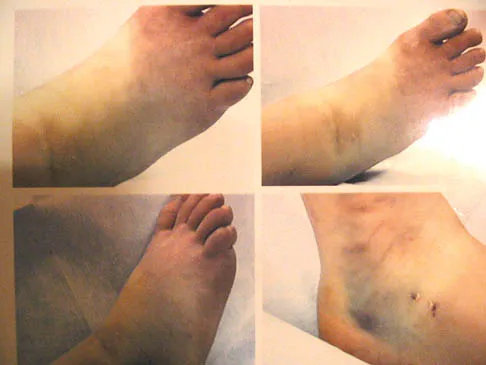 Foot & Ankle 2006 Practice Questions: Set 3 (Solved) - Figure 11