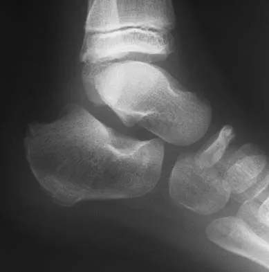 Foot & Ankle 2006 Practice Questions: Set 3 (Solved) - Figure 12