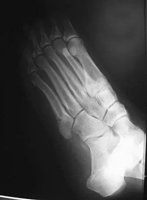 Foot & Ankle 2006 Practice Questions: Set 3 (Solved) - Figure 15