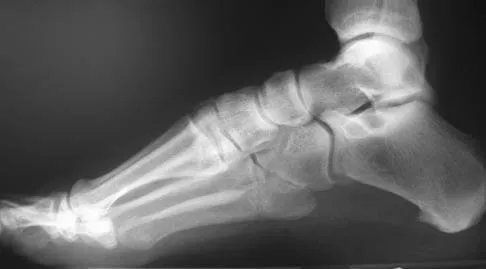 Foot & Ankle 2006 Practice Questions: Set 3 (Solved) - Figure 16