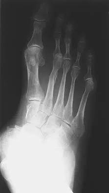 Foot & Ankle 2006 Practice Questions: Set 3 (Solved) - Figure 7