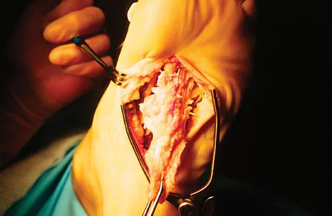 Foot & Ankle Board Review 2006: High-Yield MCQs (Set 4) - Figure 10