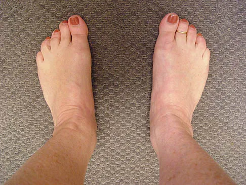 Foot & Ankle Board Review 2006: High-Yield MCQs (Set 4) - Figure 18