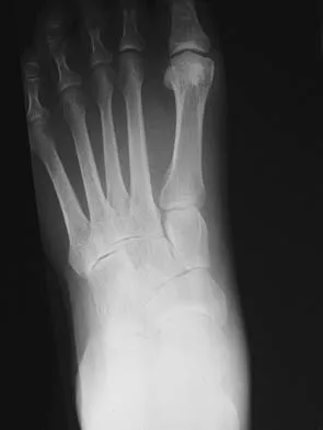 Foot & Ankle Board Review 2006: High-Yield MCQs (Set 4) - Figure 20