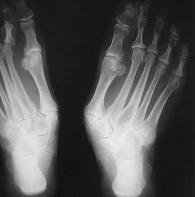 Foot & Ankle Board Review 2006: High-Yield MCQs (Set 4) - Figure 25