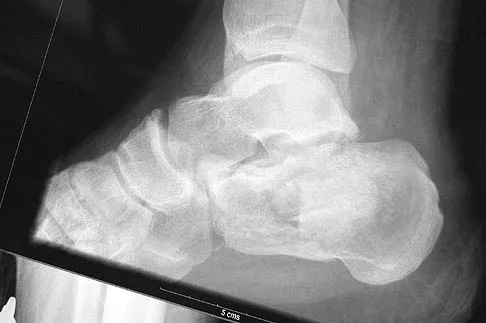 Foot & Ankle Board Review 2006: High-Yield MCQs (Set 4) - Figure 3