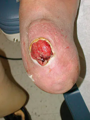 Foot & Ankle Board Review 2006: High-Yield MCQs (Set 4) - Figure 7