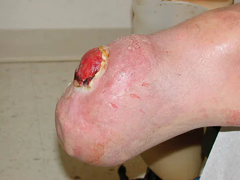 Foot & Ankle Board Review 2006: High-Yield MCQs (Set 4) - Figure 8