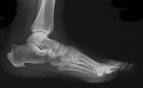 Foot & Ankle 2009 Practice Questions: Set 1 (Solved) - Figure 13