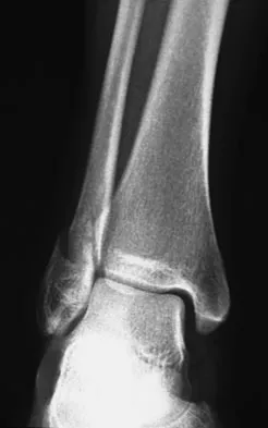 Foot & Ankle 2009 Practice Questions: Set 1 (Solved) - Figure 15