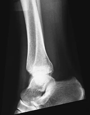 Foot & Ankle 2009 Practice Questions: Set 1 (Solved) - Figure 16