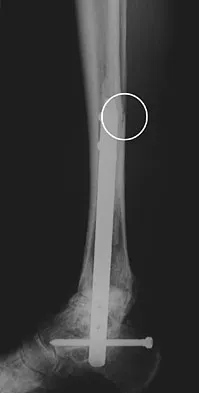 Foot & Ankle 2009 Practice Questions: Set 1 (Solved) - Figure 17