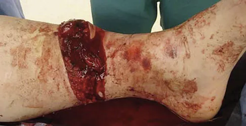 Foot & Ankle 2009 Practice Questions: Set 1 (Solved) - Figure 2