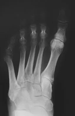 Foot & Ankle 2009 Practice Questions: Set 1 (Solved) - Figure 20