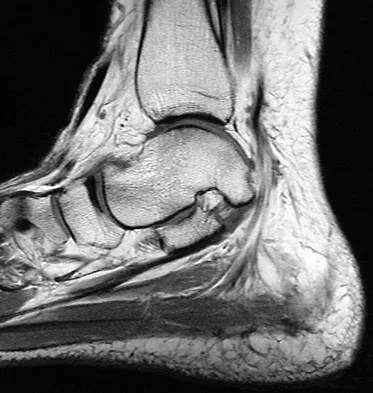 Foot & Ankle 2009 Practice Questions: Set 1 (Solved) - Figure 24