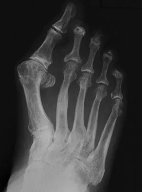 Foot & Ankle 2009 Practice Questions: Set 1 (Solved) - Figure 25