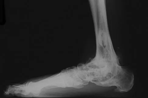 Foot & Ankle 2009 Practice Questions: Set 1 (Solved) - Figure 26