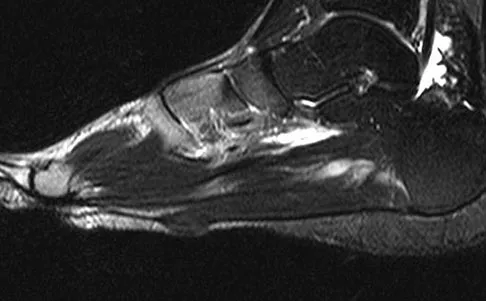 Foot & Ankle 2009 Practice Questions: Set 1 (Solved) - Figure 29