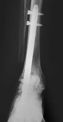 Foot & Ankle 2009 Practice Questions: Set 1 (Solved) - Figure 31