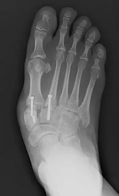 Foot & Ankle Board Review 2009: High-Yield MCQs (Set 2) - Figure 10