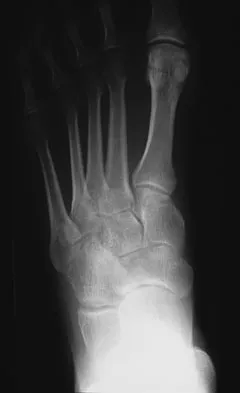 Foot & Ankle Board Review 2009: High-Yield MCQs (Set 2) - Figure 18