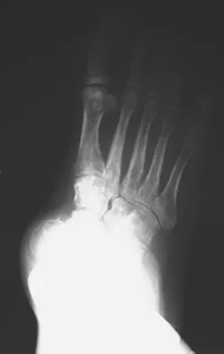 Foot & Ankle Board Review 2009: High-Yield MCQs (Set 2) - Figure 2