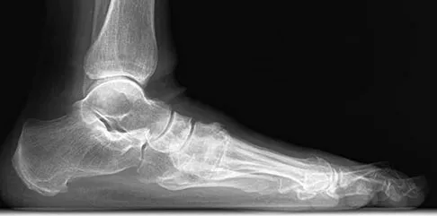 Foot & Ankle Board Review 2009: High-Yield MCQs (Set 2) - Figure 23
