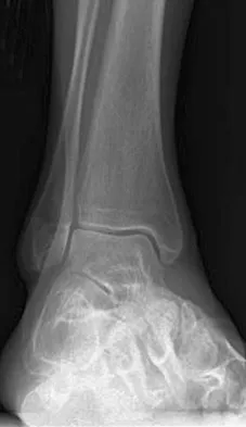 Foot & Ankle Board Review 2009: High-Yield MCQs (Set 2) - Figure 24