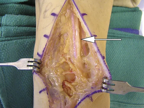 Foot & Ankle Board Review 2009: High-Yield MCQs (Set 2) - Figure 26