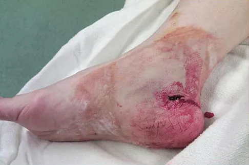 Foot & Ankle 2009 Practice Questions: Set 3 (Solved) - Figure 10