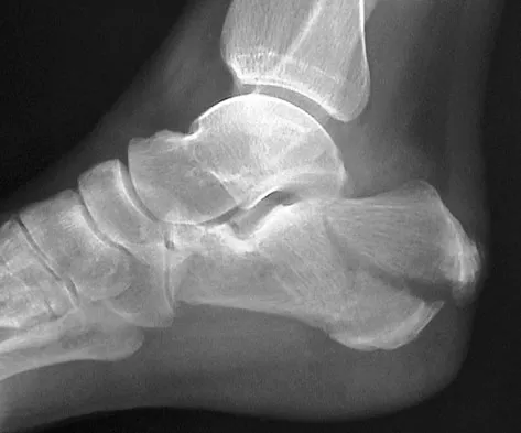 Foot & Ankle 2009 Practice Questions: Set 3 (Solved) - Figure 15