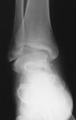 Foot & Ankle 2009 Practice Questions: Set 3 (Solved) - Figure 16