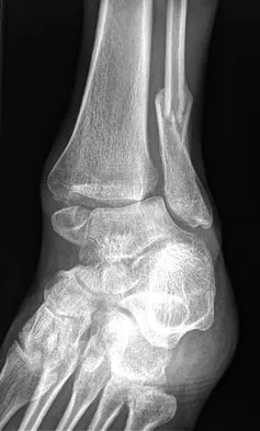 Foot & Ankle 2009 Practice Questions: Set 3 (Solved) - Figure 3