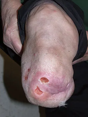 Foot & Ankle 2009 Practice Questions: Set 3 (Solved) - Figure 4