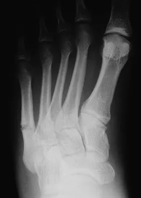 Foot & Ankle 2009 Practice Questions: Set 3 (Solved) - Figure 7