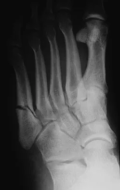 Foot & Ankle 2009 Practice Questions: Set 3 (Solved) - Figure 8