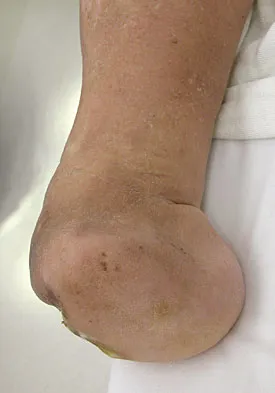 Foot & Ankle Board Review 2009: High-Yield MCQs (Set 4) - Figure 17