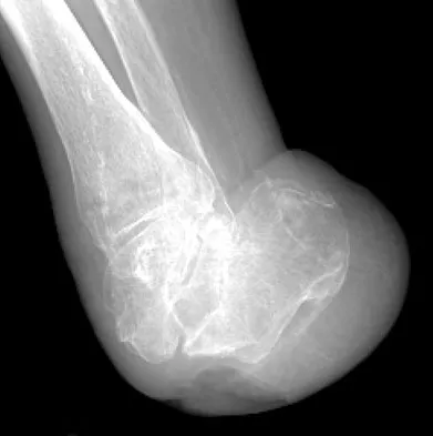 Foot & Ankle Board Review 2009: High-Yield MCQs (Set 4) - Figure 18