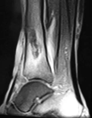 Foot & Ankle Board Review 2009: High-Yield MCQs (Set 4) - Figure 20